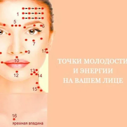 Иглотерапия